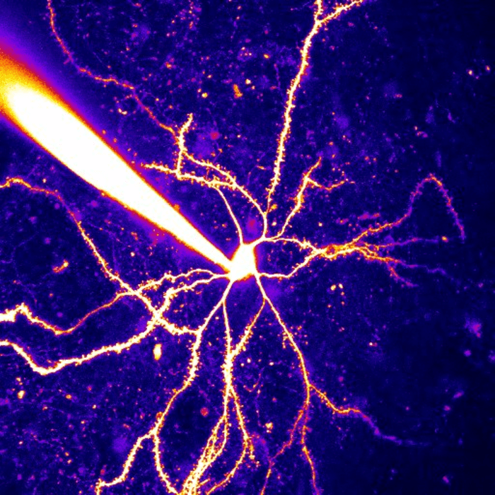 Striatal neuron