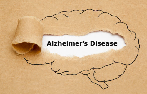 Alzheimers Disease
