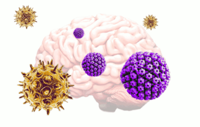 Alzheimer's disease caused by common viruses?
