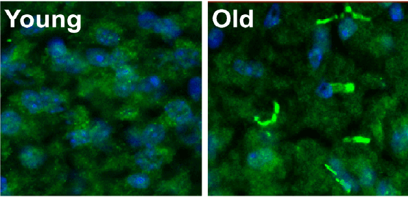 PDE11A memory enzyme (green) in the brains of young (left) and old (right) mice.
