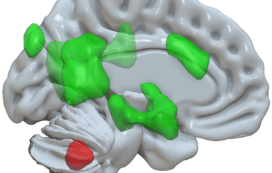 The cerebellum and emotional memory