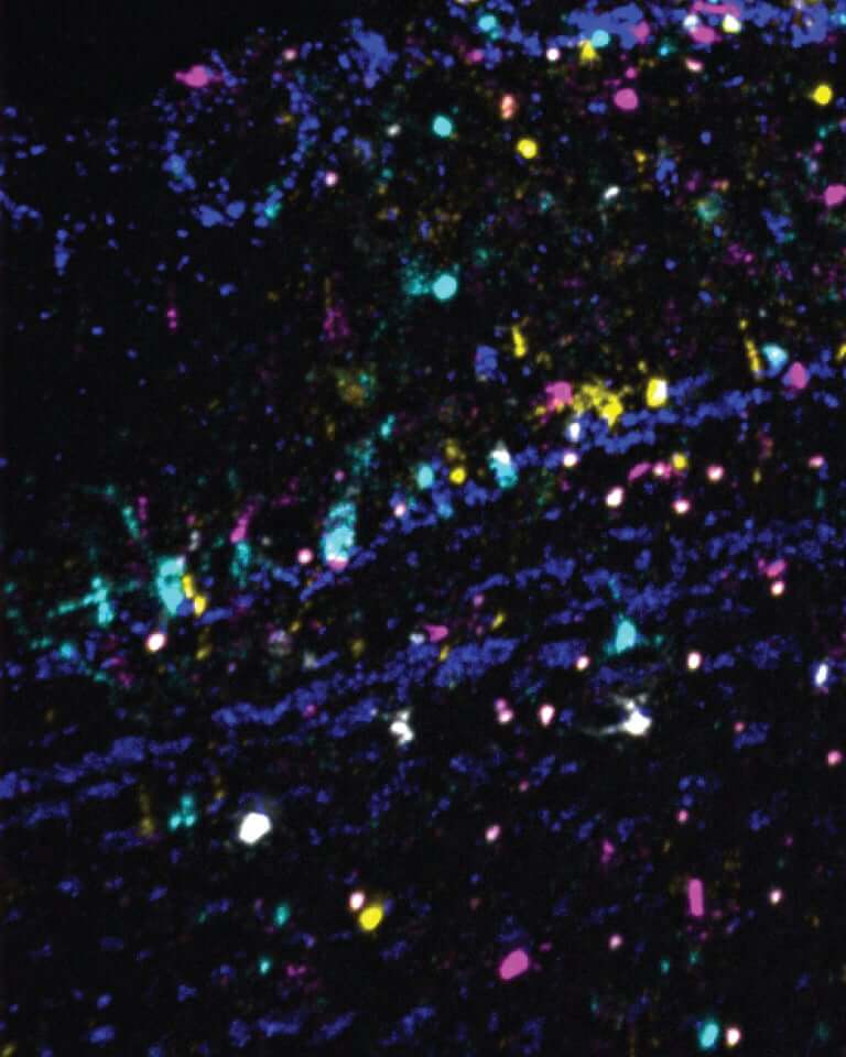 Researchers used the brain mapping technology, BARseq, to study hundreds of neurons at a time in the mouse olfactory bulb