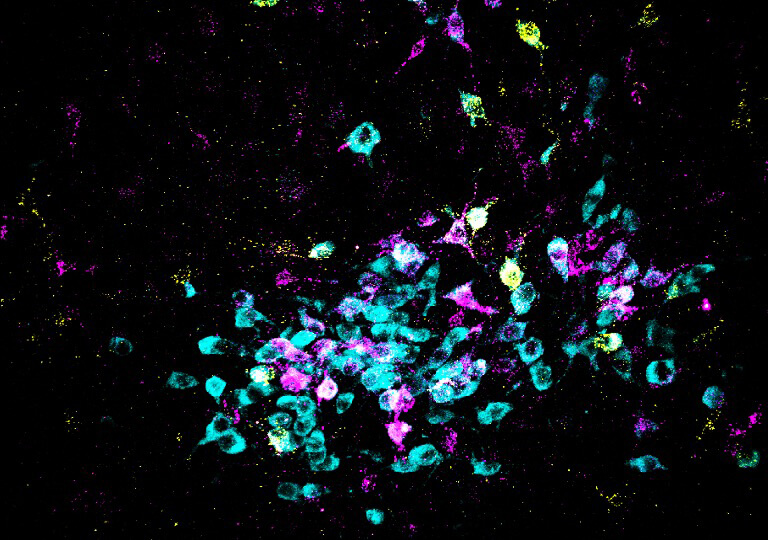 Here, neurons are shown in cyan and retrograde tracers shown in yellow and magenta.