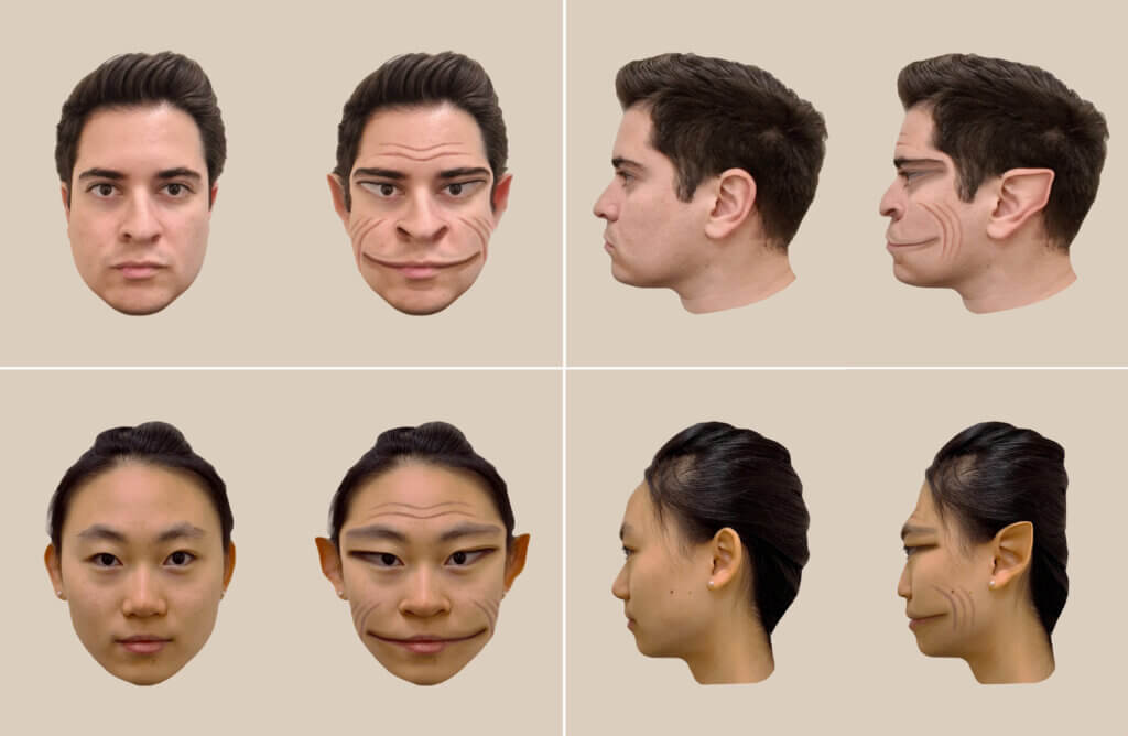 Computer-generated images of the distortions of a male face (top) and female face (bottom), as perceived by the patient in the study