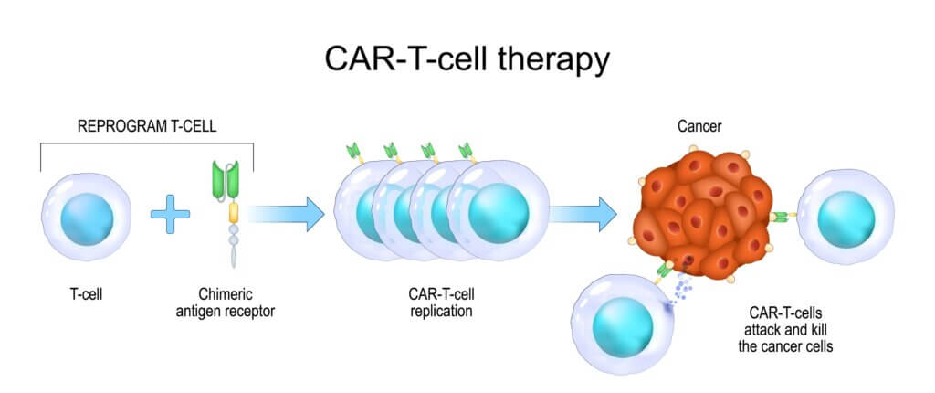 CAR T-cell therapy diagram
