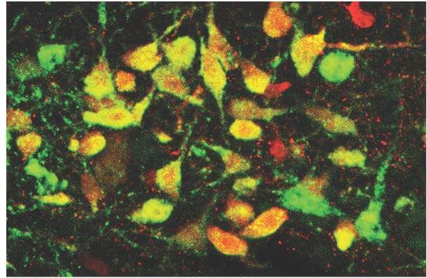 An image of the dorsal raphe, an area located in the brainstem, shows serotonergic neurons in green, a virally expressed TdTomato protein in red and colocalized cells in yellow.