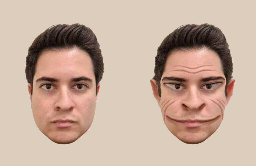 Computer-generated images of the distortions of a male face, as perceived by the patient in the study.