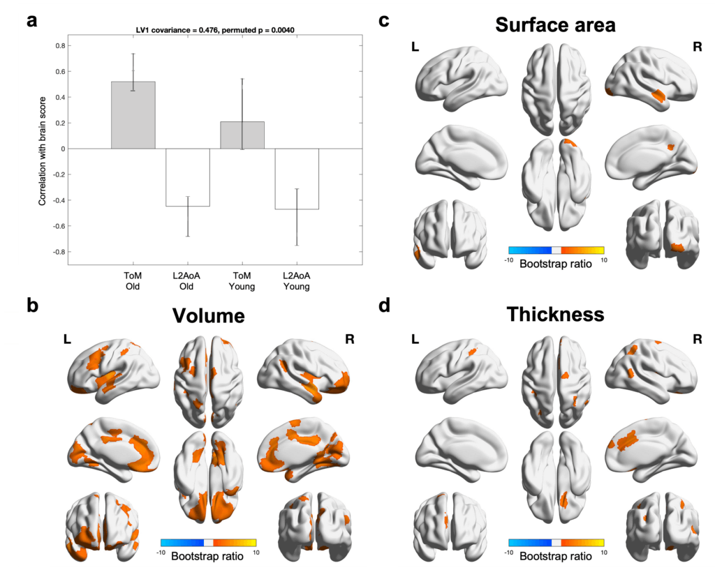 Higher gray matter volume, larger surface area, and greater cortical thickness were associated with earlier bilingual acquisition and better performance in theory of mind