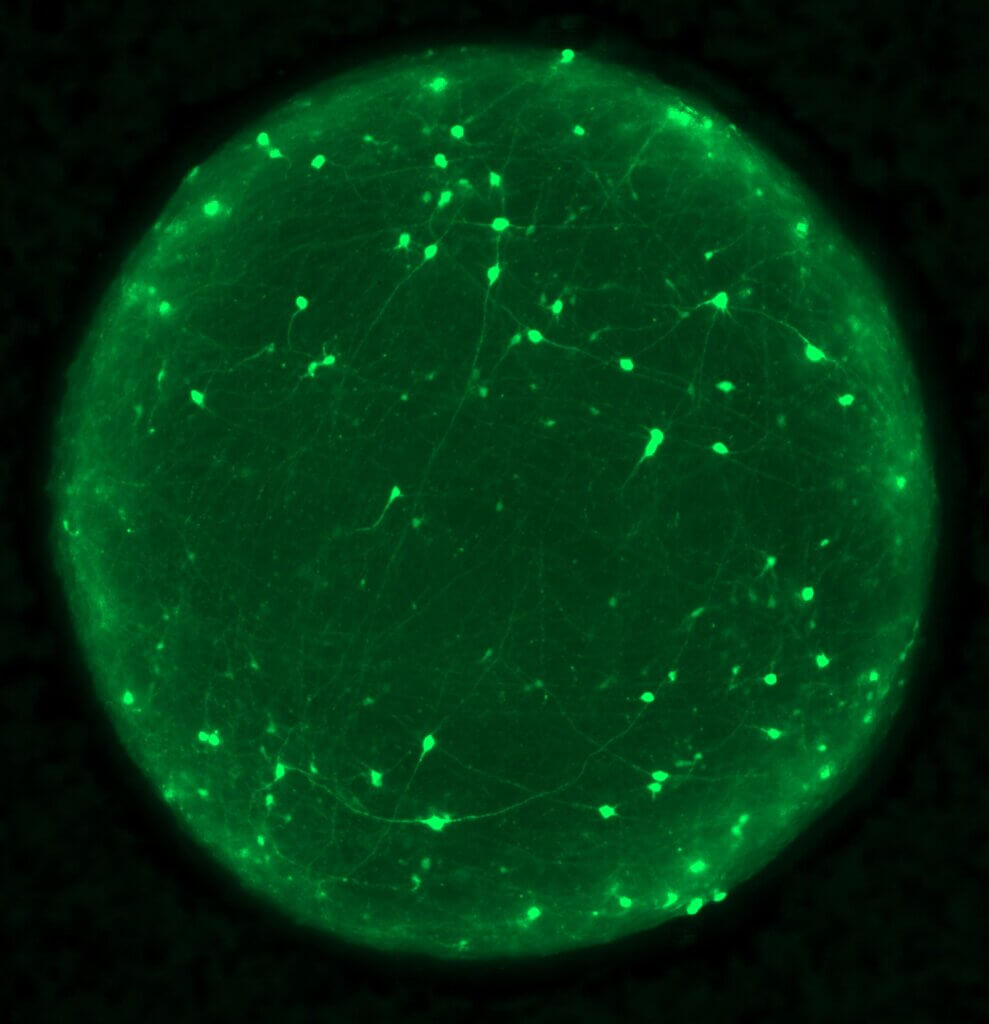 Organoid with neurons labeled in green. 