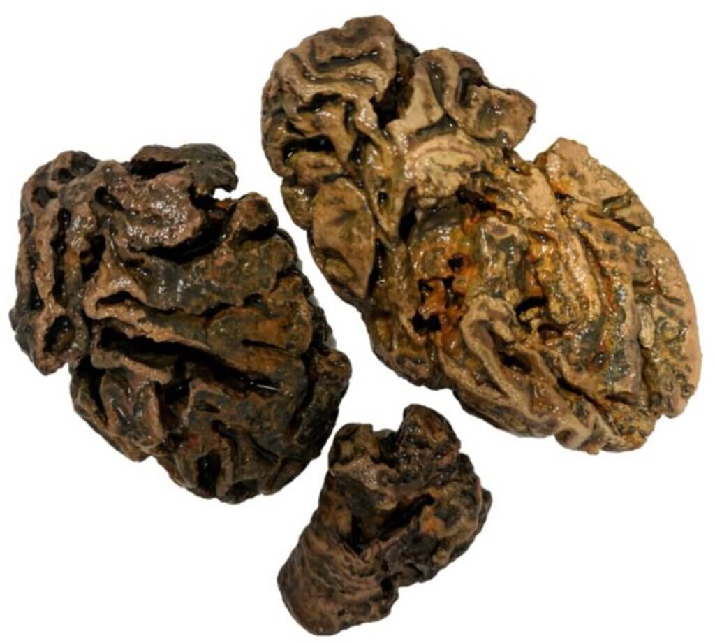 Fragments of brain from an individual buried in a Victorian workhouse cemetery (Bristol, UK), some 200 years ago. No other soft tissue survived amongst the bones, which were dredged from the heavily waterlogged grave